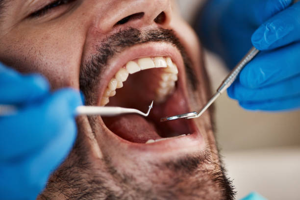 Best Emergency Dental Care for Abscessed Tooth in Collinwood, TN